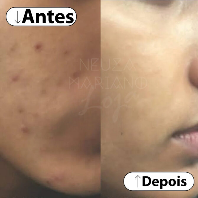 Creme de Noite Pérola - Manchas e pele escura - Image 10