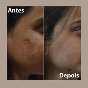 creme perola antes e depois 2
