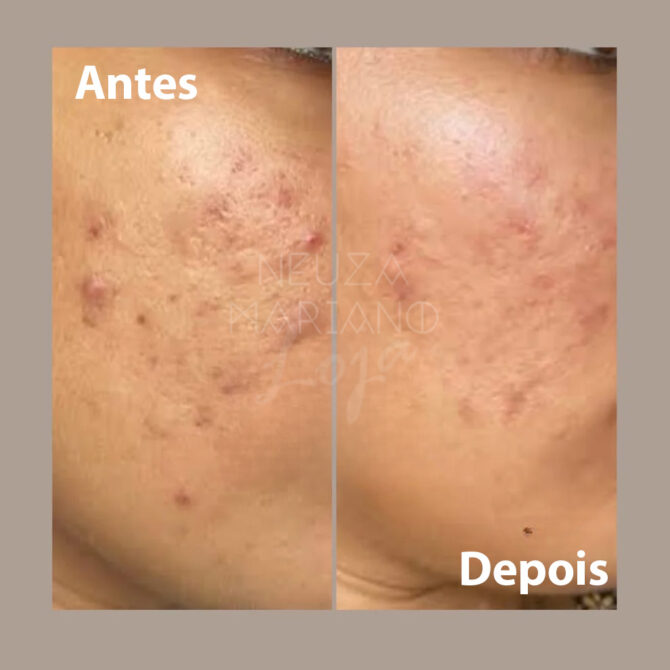 Creme de Noite Pérola - Manchas e pele escura - Image 9
