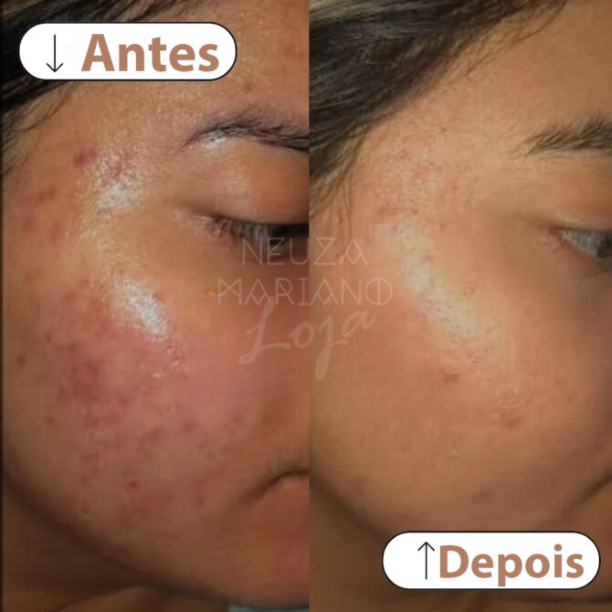 Creme de Noite Pérola - Manchas e pele escura - Image 7