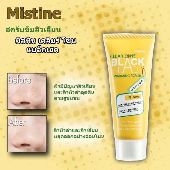Esfoliante Quente para Pontos Negros e Acne 2 Esfoliante Quente para Pontos Negros e Acne
