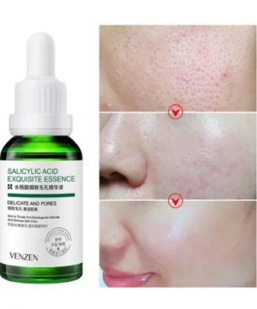Venzen Salicylic Acid Essence