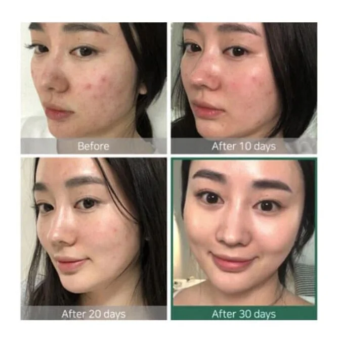 Some By Mi AHA-BHA-PHA 30 Days Miracle Toner 30ml - Image 2