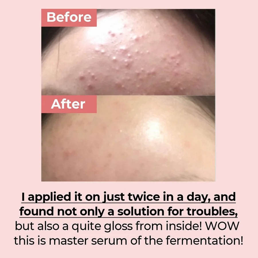 sérum suavizante de pele - vista 3