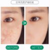 Mentholatum Acnes Anti-Acne Spot Gel