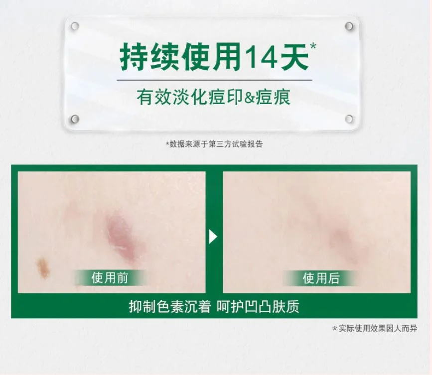 gel anti-acne - vista 4