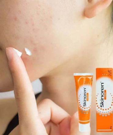 Inicio 8 Skinoren Cream