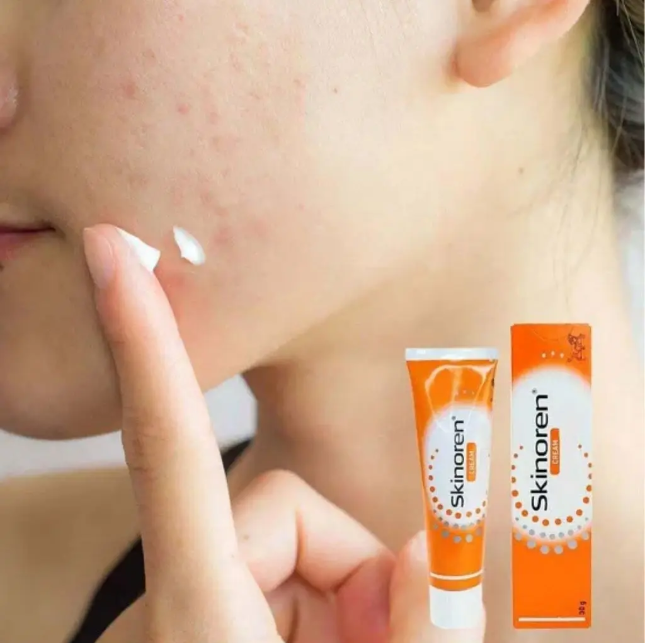 Skinoren Cream 20% (Ácido Azelaico) - Tratamento Eficaz para Acne, Rosácea, Manchas e Melasma 2 Skinoren Cream