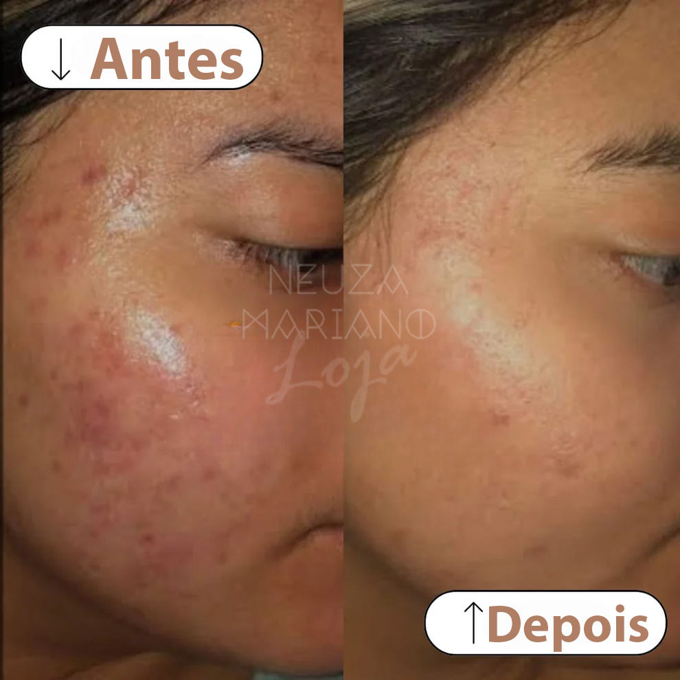 Pearl Night Cream - Whitening and Rejuvenation 6 creme de noite pérola - vista 7
