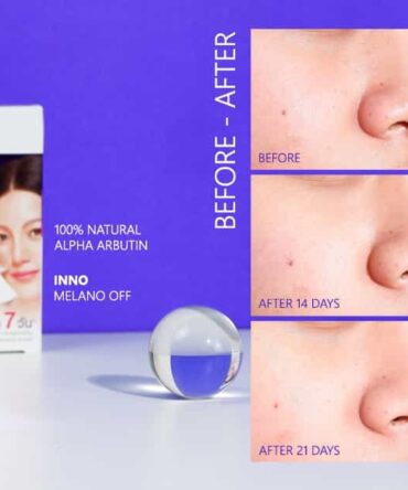 creme para melasma - vista 2