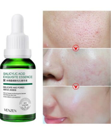 Venzen Salicylic Acid Essence