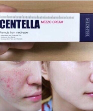creme MEDI-PEEL Centella - vista 2