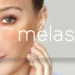 Melasma