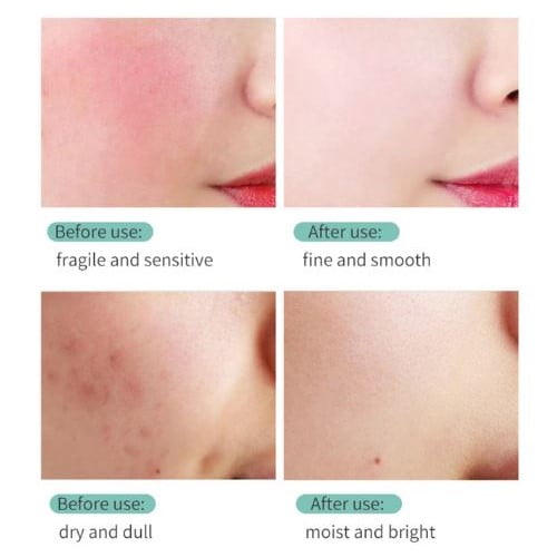 Centella Asiatica Cream - Repair and Deep Hydration 4 creme de Centella Asiática - vista 4