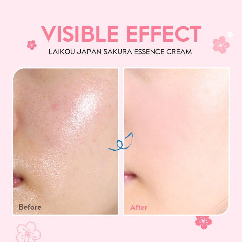 Laikou Japanese Cherry Blossom Essence Cream 2 creme hidratante facial - vista 2