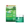 creme gel acne