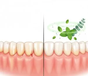 A diferença nas gengivas é VISÍVEL