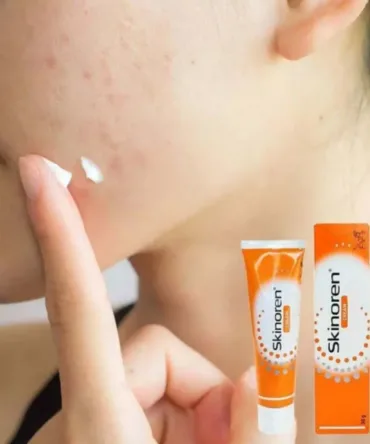 Skinoren Cream