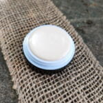 melasma 